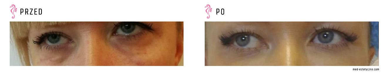 Gabinet dr Joanny Janeckiej najniższe ceny medycyna estetyczna woj. śląskie