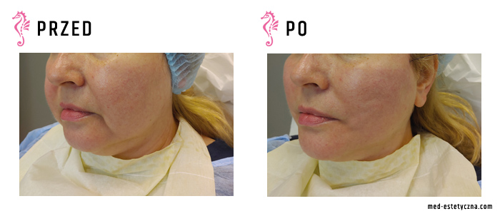 Gabinet dr Joanny Janeckiej najniższe ceny medycyna estetyczna woj. śląskie