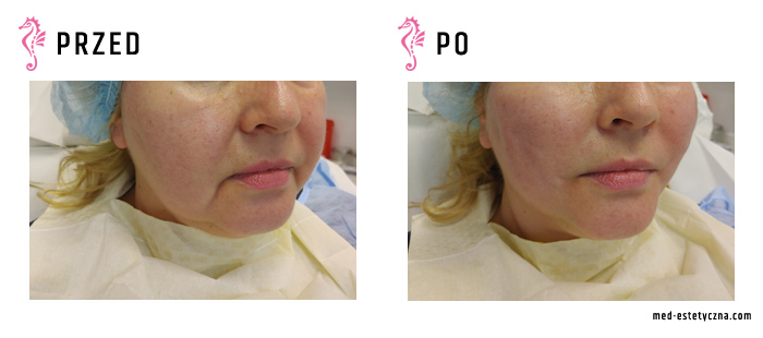 Gabinet dr Joanny Janeckiej najniższe ceny medycyna estetyczna woj. śląskie