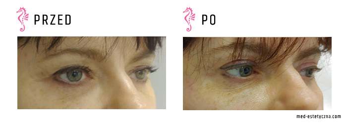 Gabinet dr Joanny Janeckiej najniższe ceny medycyna estetyczna woj. śląskie