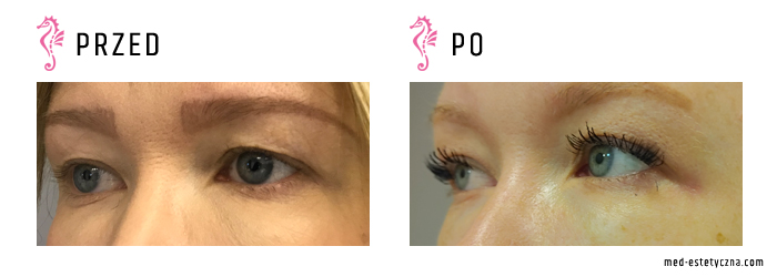 Gabinet dr Joanny Janeckiej najniższe ceny medycyna estetyczna woj. śląskie