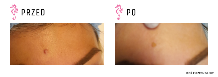 Gabinet dr Joanny Janeckiej najniższe ceny medycyna estetyczna woj. śląskie