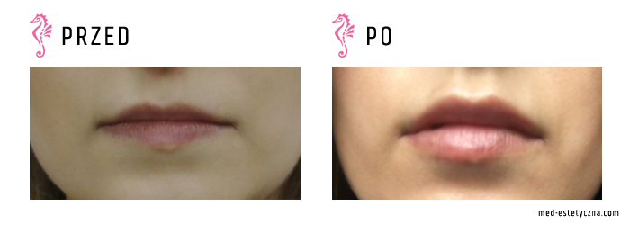 Gabinet dr Joanny Janeckiej najniższe ceny medycyna estetyczna woj. śląskie