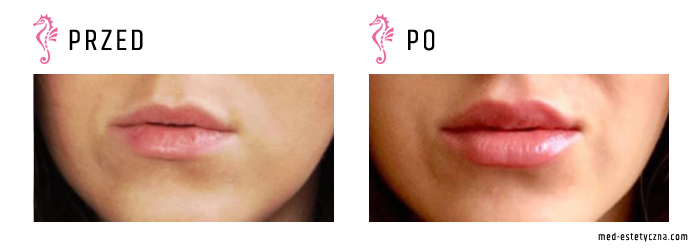 Gabinet dr Joanny Janeckiej najniższe ceny medycyna estetyczna woj. śląskie