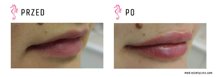 Gabinet dr Joanny Janeckiej najniższe ceny medycyna estetyczna woj. śląskie