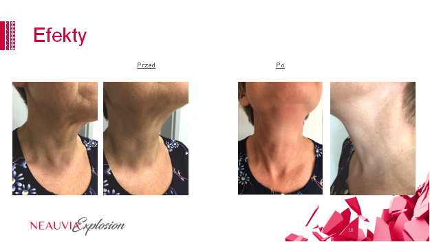 Gabinet dr Joanny Janeckiej najniższe ceny medycyna estetyczna woj. śląskie